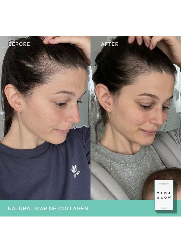 Vida Glow Natural Marine Collagen Original Sachets
