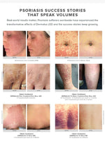 Dermalux Flex MD