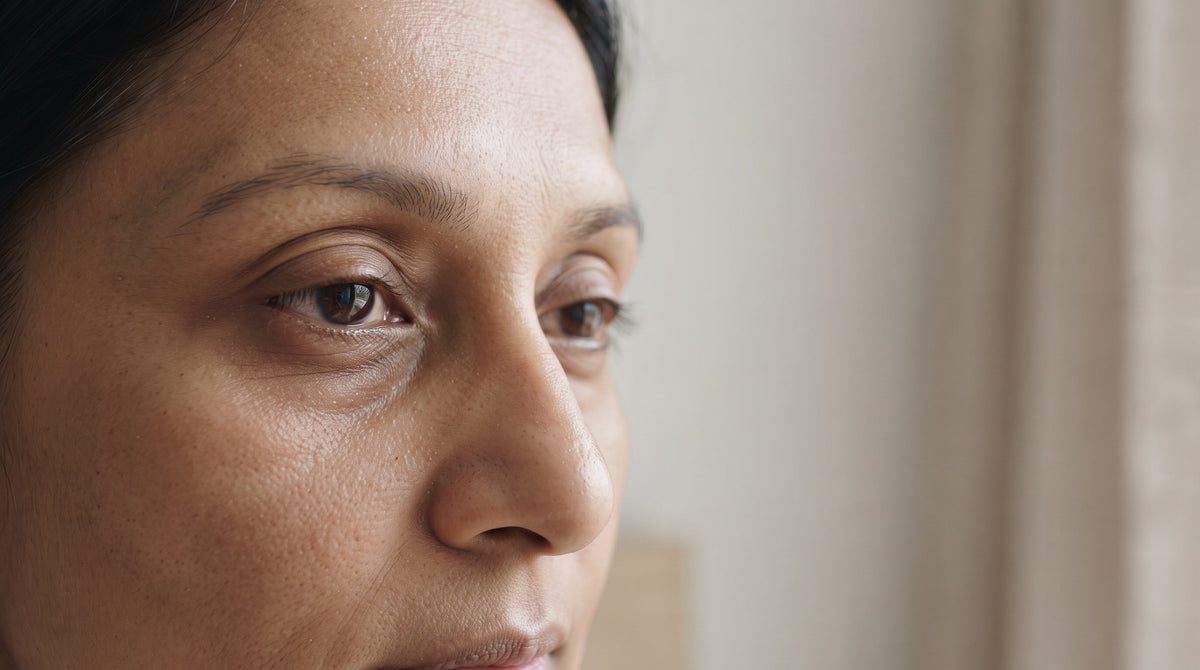 Close-up of undereye area showing natural hollowing associated with age-related volume loss