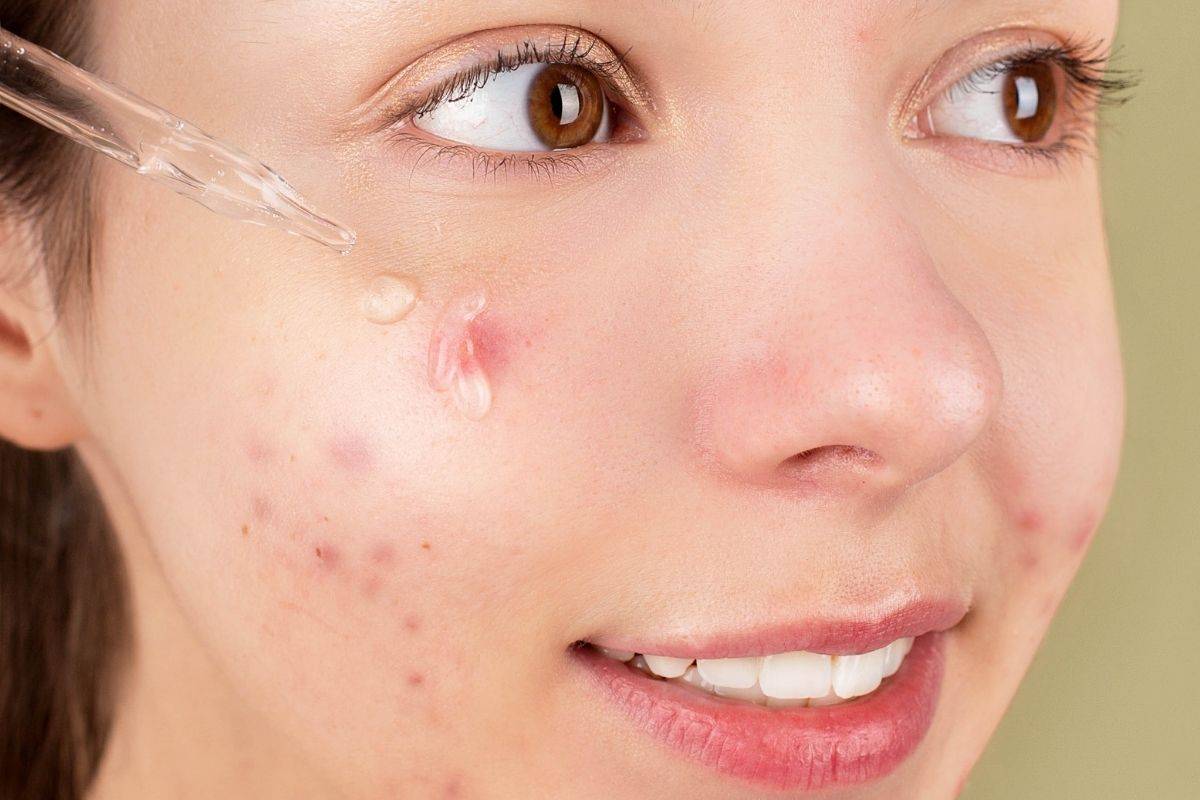 Targeted Treatments: From Good Skin to Great Skin