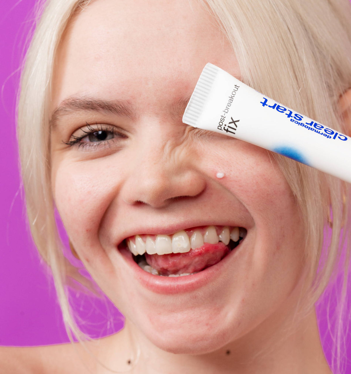 NEW! Clear Start Post-Breakout Fix