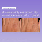 Dermalogica Stabilizing Repair Serum